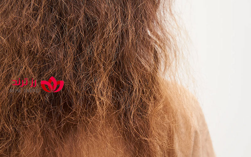 درمان خشکی مو