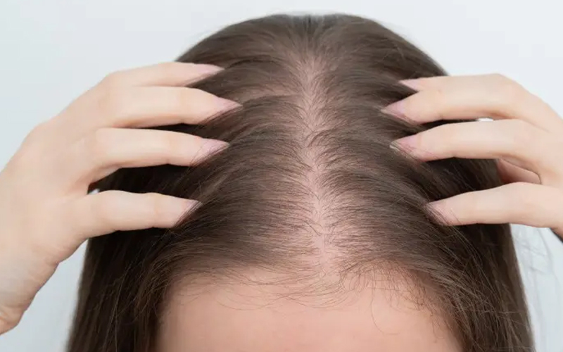 بهترین شامپو برای ریزش مو