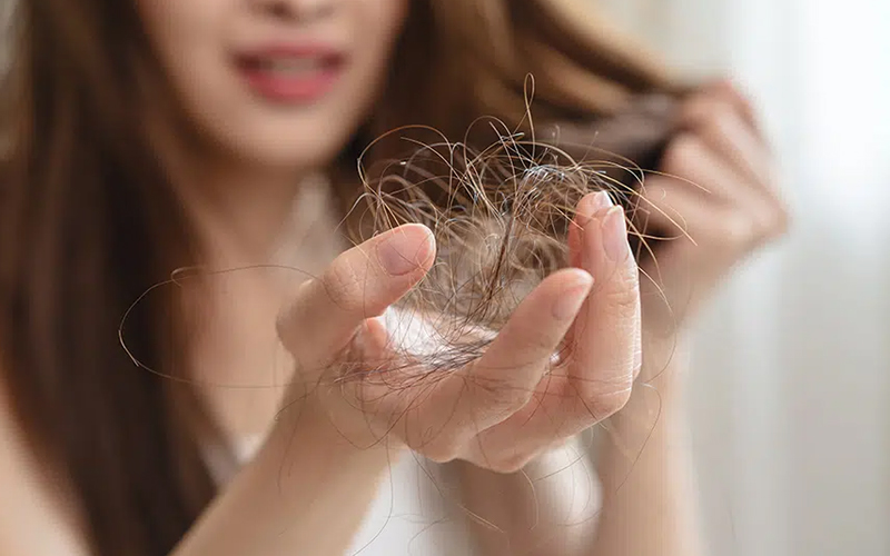 بهترین شامپو ضد ریزش مو